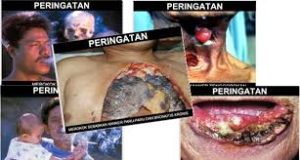 Gambar Seram Rokok